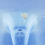 Bluewave Replacement Air Plugs - 5 Pieces